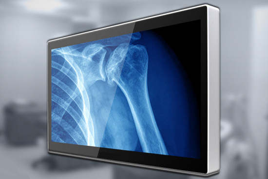 Winmate Sdi Monitor Da2